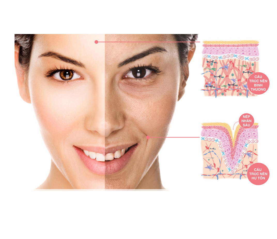 Collagen type III làm bí quyết trẻ hoá da trong thẩm mỹ hiện đại 
