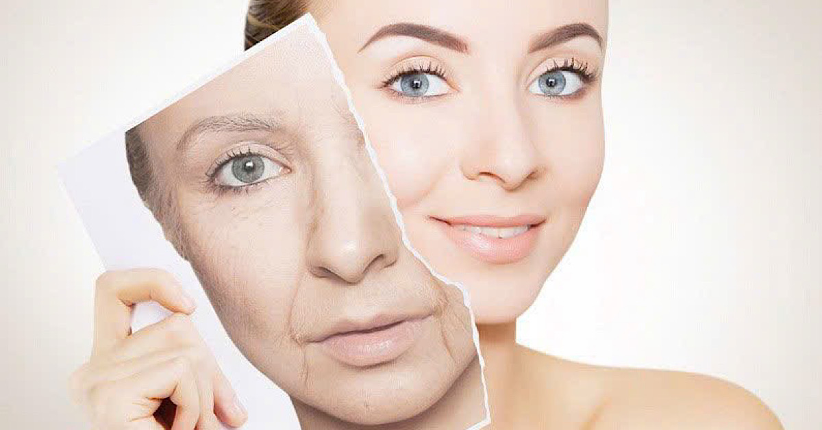 Collagen Type I chiếm khoảng 90% tổng lượng collagen trong cơ thể