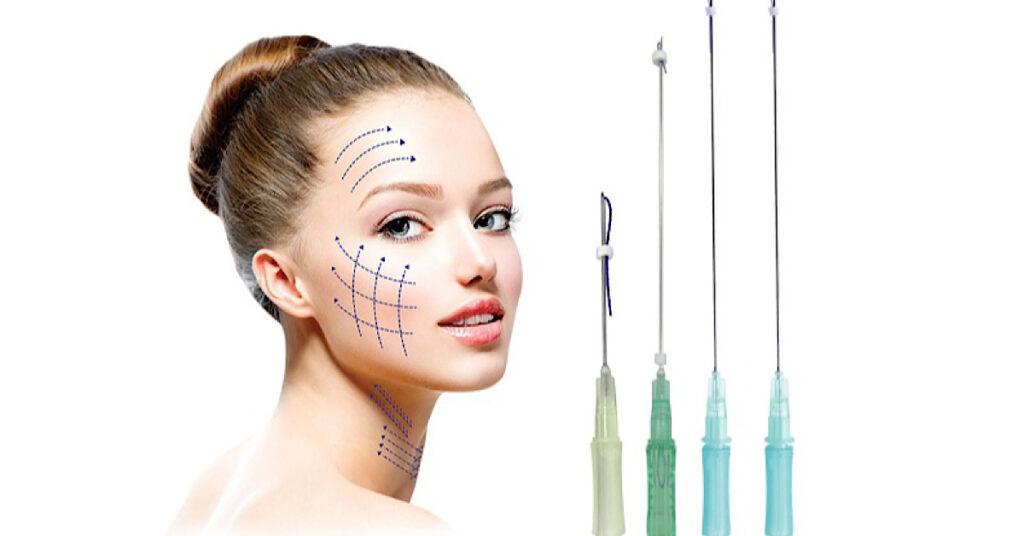 Chỉ FIGO là gì? Tất tần tật về dòng chỉ sinh học hàng đầu thị trường