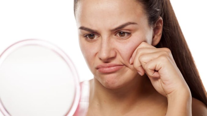 Linerase collagen giúp cải thiện làn da lão hoá sớm