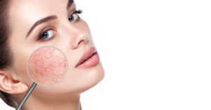 Dr. Scar - giải pháp trị sẹo mụn an toàn, chuyên biệt cho da nhạy cảm