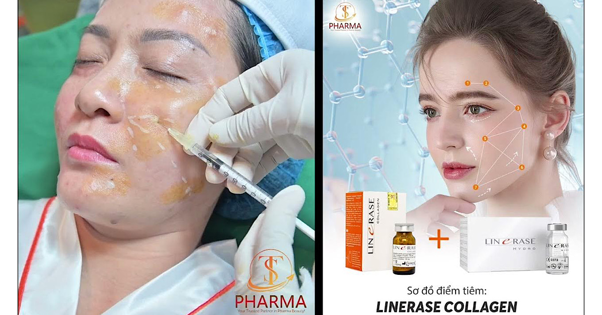 Tiêm collagen giúp cải thiện làn da lão hoá