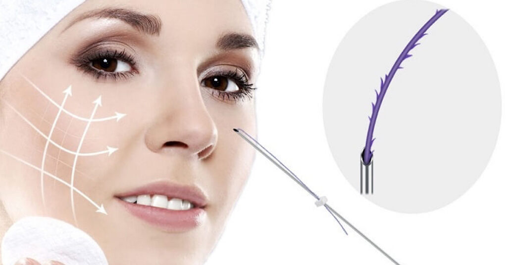 Yếu tố con người đóng vai trò quan trọng trong sự hiệu quả của chỉ FIGO