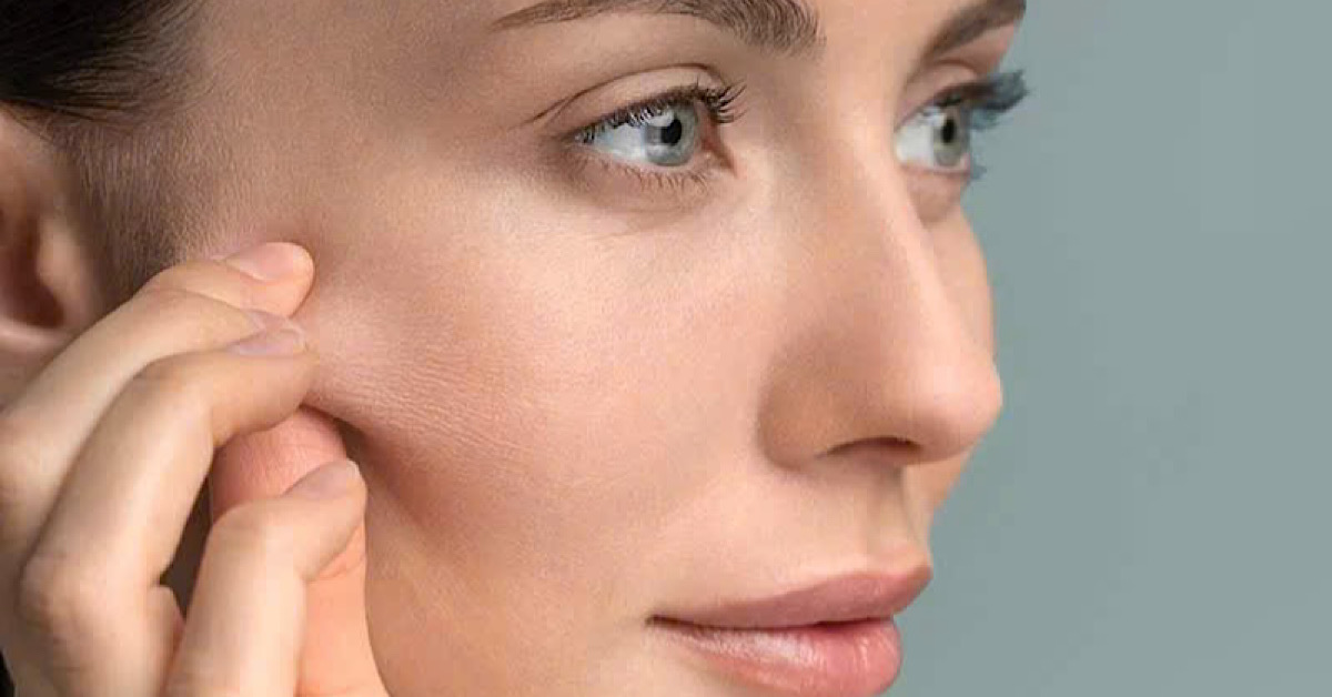 Làn da xuất hiện nếp nhăn nhỏ, kém đàn hồi