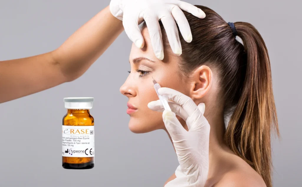 Linerase - Liệu pháp trẻ hoá sinh học tới từ châu Âu