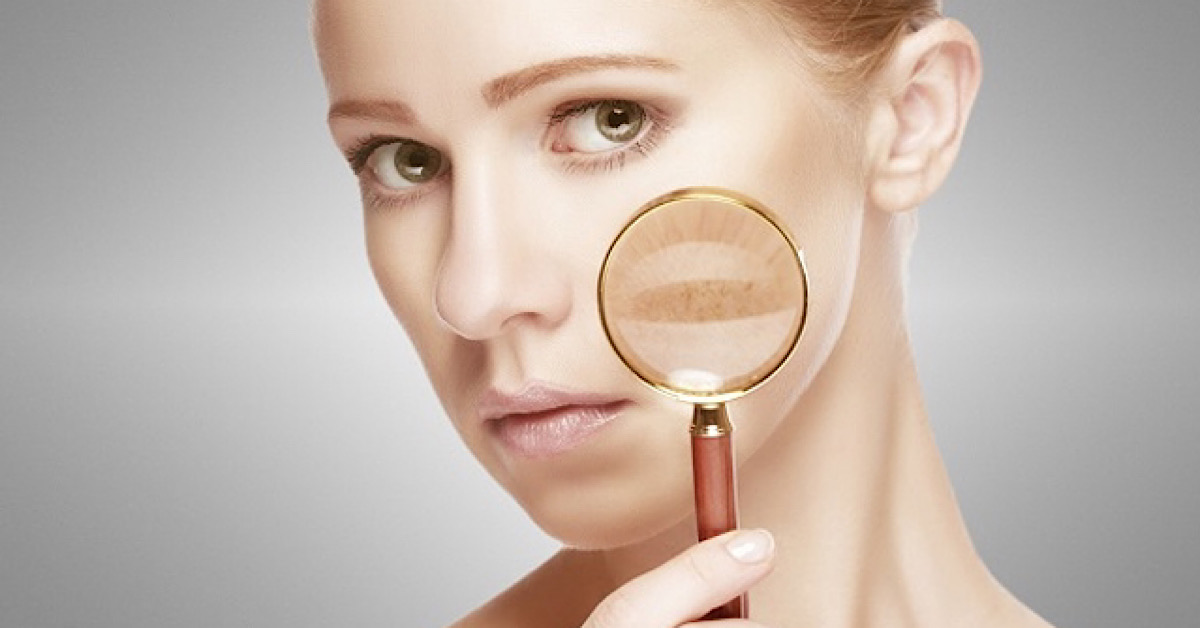 Da mất đi độ đàn hồi và săn chắc