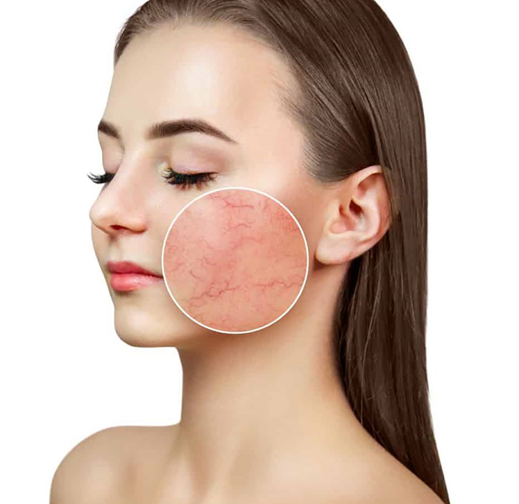 Phục hồi da mỏng yếu, tổn thương sau treatment