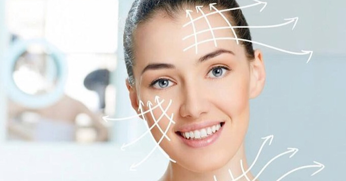 Chỉ FIGO kích thích bổ sung collagen tự nhiên và bền vững