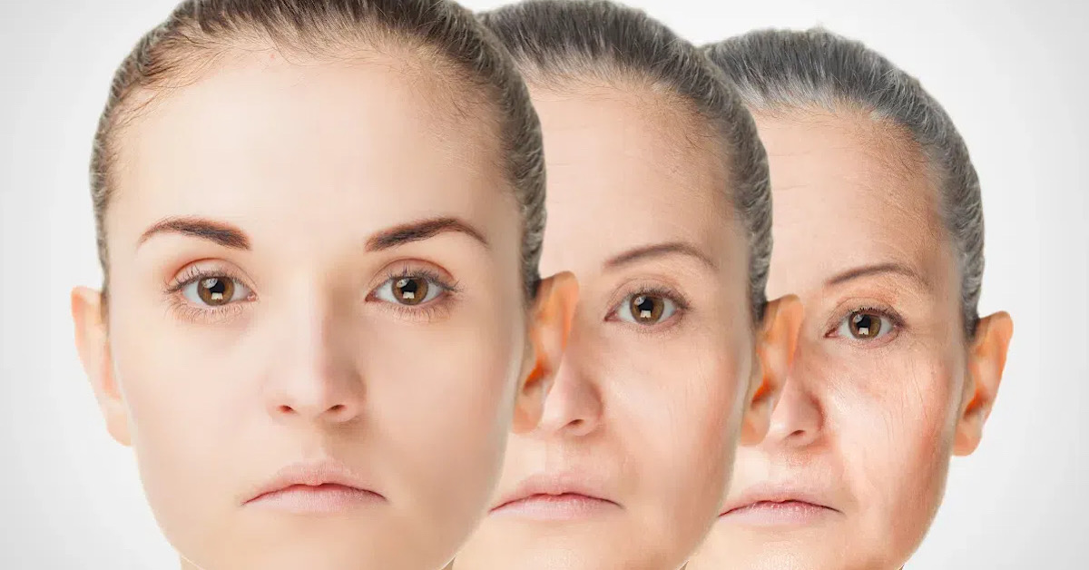 Đường viền hàm bị chảy xệ