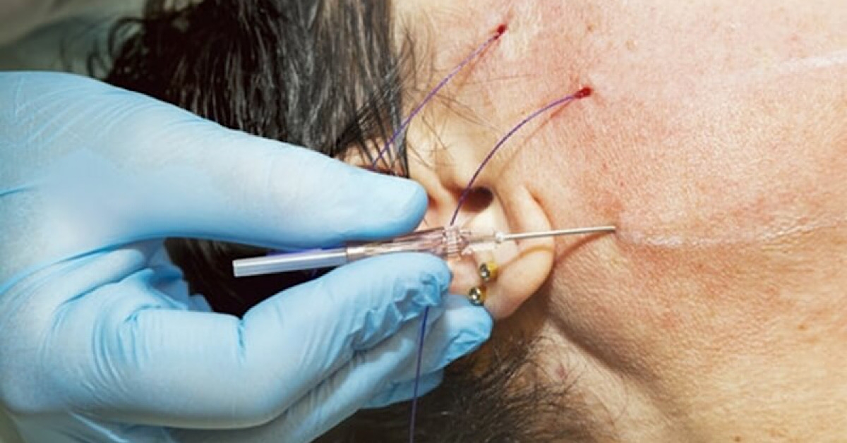 FIGO – Giải pháp làm đẹp an toàn, hiệu quả, bền vững