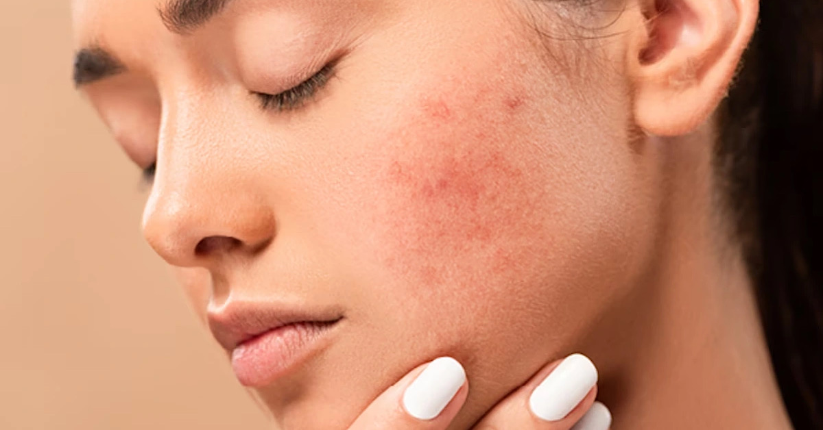 Da mỏng và dễ tổn thương hơn