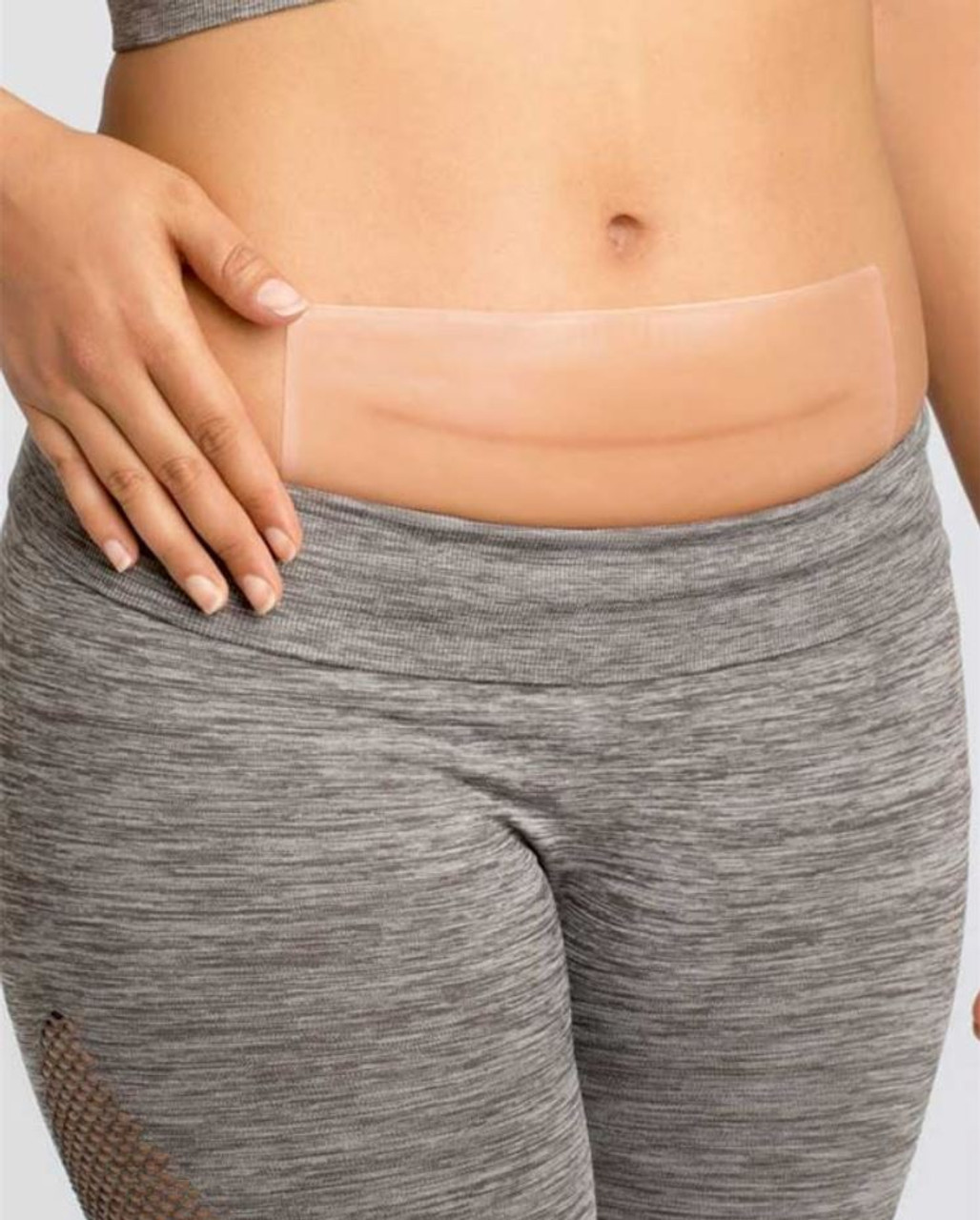 Amoena Curascar với công dụng vượt trôi trị seo sau sinh